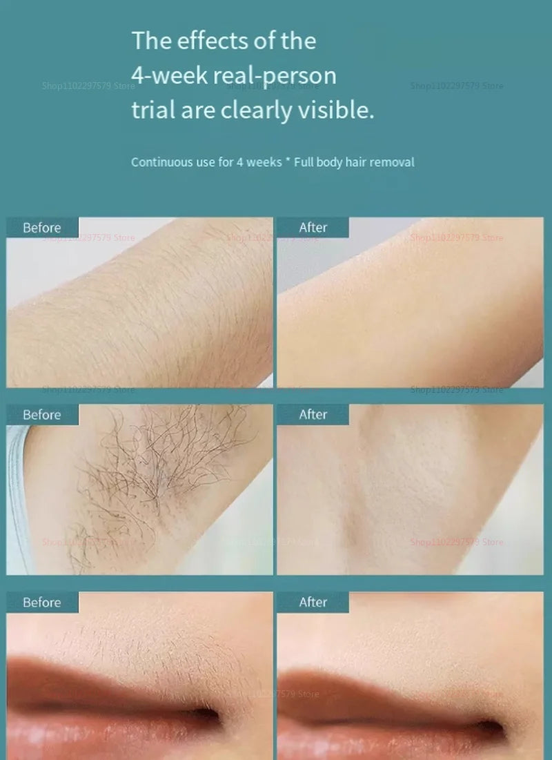 Shaver Pulse IPL Women's Epilator Home Equipment R Epilator 500,000 Flashes Body Pussy Bikini Laser Pulse Hair Removal